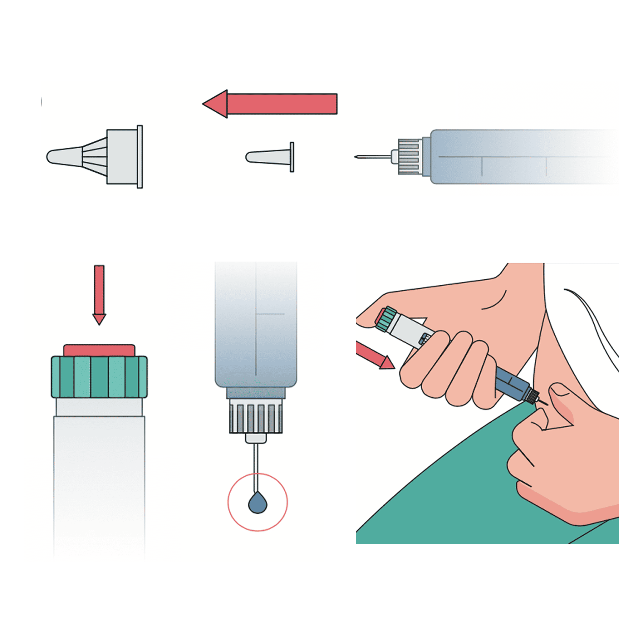 injection steps